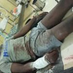 Horror ! How Police STS Shot Teenager, Brutalized Family Members In Abuja On Suspicion